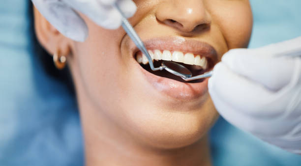 Best Emergency Dentist for Lost Fillings or Crowns in Valley Falls, SC